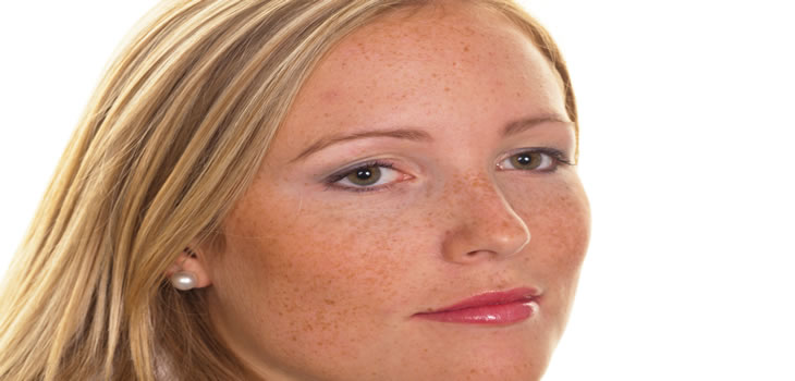 woman with skin disorder